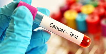 صفر تا صد غربالگری سرطان‌های گوارشی 