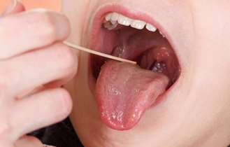 بی‌توجهی به درمان لوزه‌های بزرگ عارضه‌های همیشگی به همراه دارد