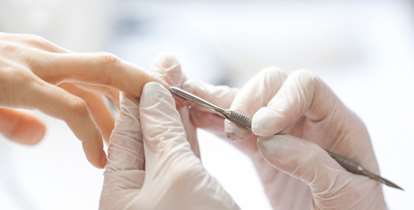 بروز قارچ در ناخن کاشت شده را جدی بگیرید