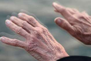 نقش موثر ورزش در کاهش پیشرفت علایم پارکینسون