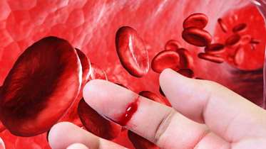 ایران، نهمین کشور جهان از نظر تعداد مبتلایان به هموفیلی