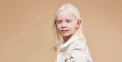 وقتی آفتاب با همه مهربان نیست