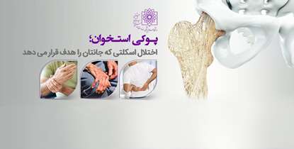 پوکی استخوان؛ اختلال اسکلتی که جانتان را هدف قرار می دهد