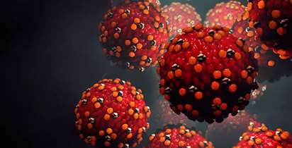 بزرگسالان هم به سرخک مبتلا می شوند؟/درمان سرخک را جدی بگیرید