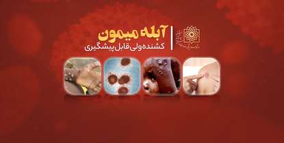 بیماری آبله میمون خطرناک ولی قابل پیشگیری
