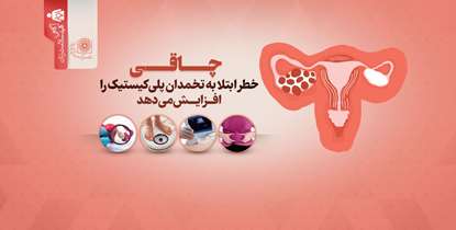 آگاهی؛ کلید سلامت زنان/ چاقی خطر ابتلا به تخمدان پلی کیستیک را افزایش می‌دهد