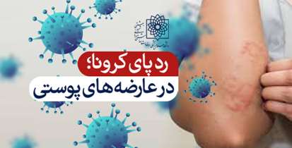 رد پای ویروس کرونا در عارضه های پوستی