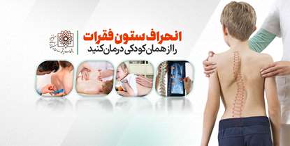 انحراف ستون فقرات را از همان کودکی درمان کنید