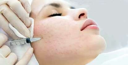 مراقب عوارض "مزوتراپی" باشید