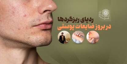 راههای محافظت از سلامت پوست در برابر ریزگردها