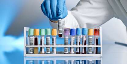 بررسی 59 پرونده موسسه علوم آزمایشگاهی در معاونت درمان