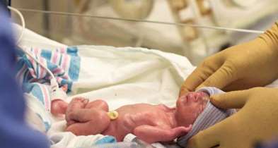 احیای قلبی ریوی، اساسی ترین شرط کاهش آمار مرگ و میر نوزادان 
